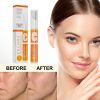 VC Whitening Instant Blemish Pen Remove Melasma Pigment Melanin Dark Spot Gel Freckle Cream Face Brighten Skin Repair Anti Aging - 1