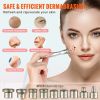 VEVOR Diamond Microdermabrasion Machine 3 in 1 Facial Beauty Equipment for Salon - Default